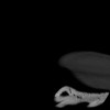 SPORK, NICO - 22.03.1976 - 02.08.2022 - CT obere Extremität - 17:59:38